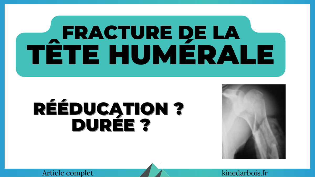 Fracture tête humérale Douleur, rééducation, durée
