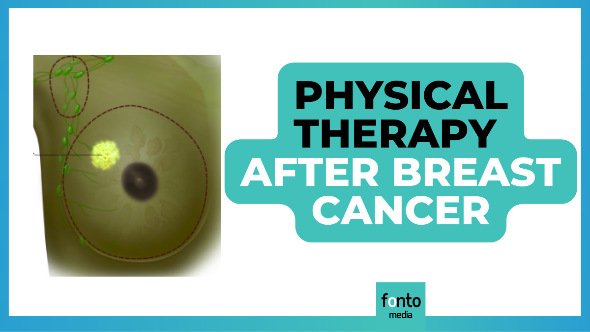 5 Key Insights of Physical Therapy After Breast Cancer (+ Tips)