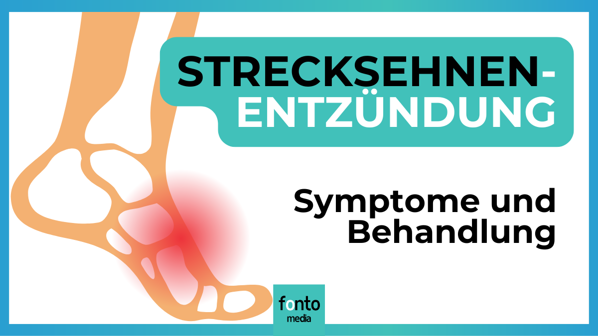 Strecksehnenentzündung (Fußrücken): Alles, was du wissen musst